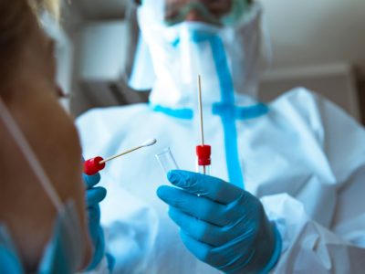 Chi phí xét nghiệm RT – PCR Covid – 19 tại 5 bệnh viện tư hàng đầu tại Hà Nội
